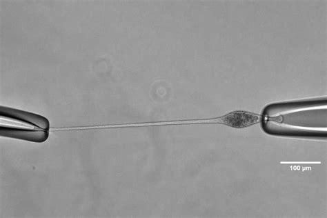   Uniophora: A Single-Celled Predator Lurking Within its Hosts!